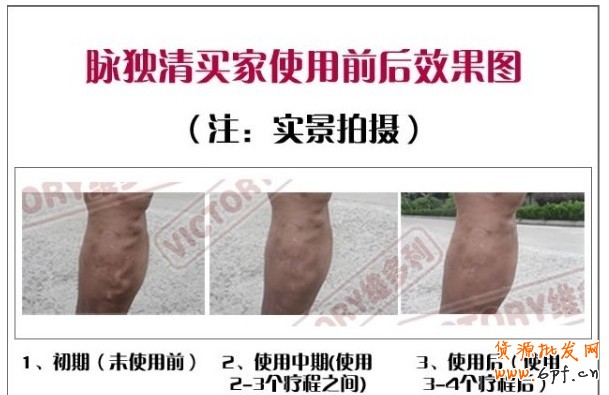 47.【亮鉆計劃】拒絕理由解析&mdash;&mdash;涉及真人對比的解決方案